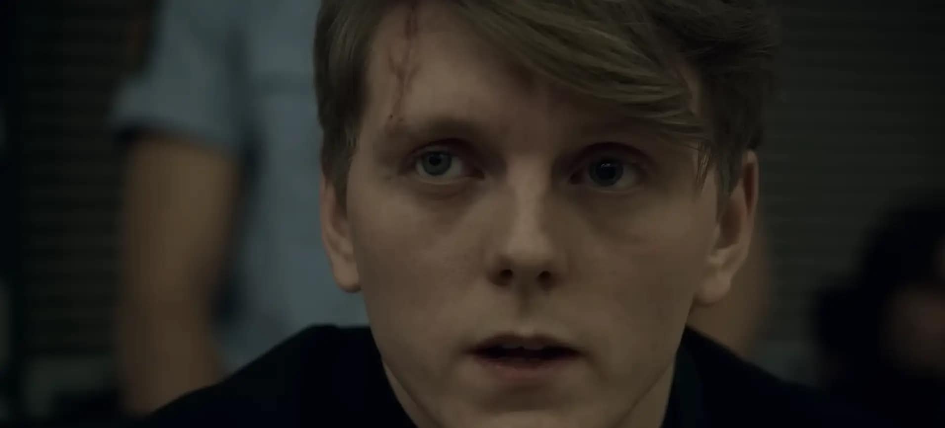 Close up shot of actor Jonas Strand Gravli as Viljar Hanssen in the movie, “22 July” (2018) displaying physical scars and emotional trauma.